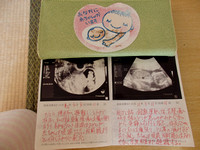 すりきれた妊婦マークと避難当時の我が子 (Worn-Out Maternity Sticker and Ultrasound of My Child when we Evacuated)